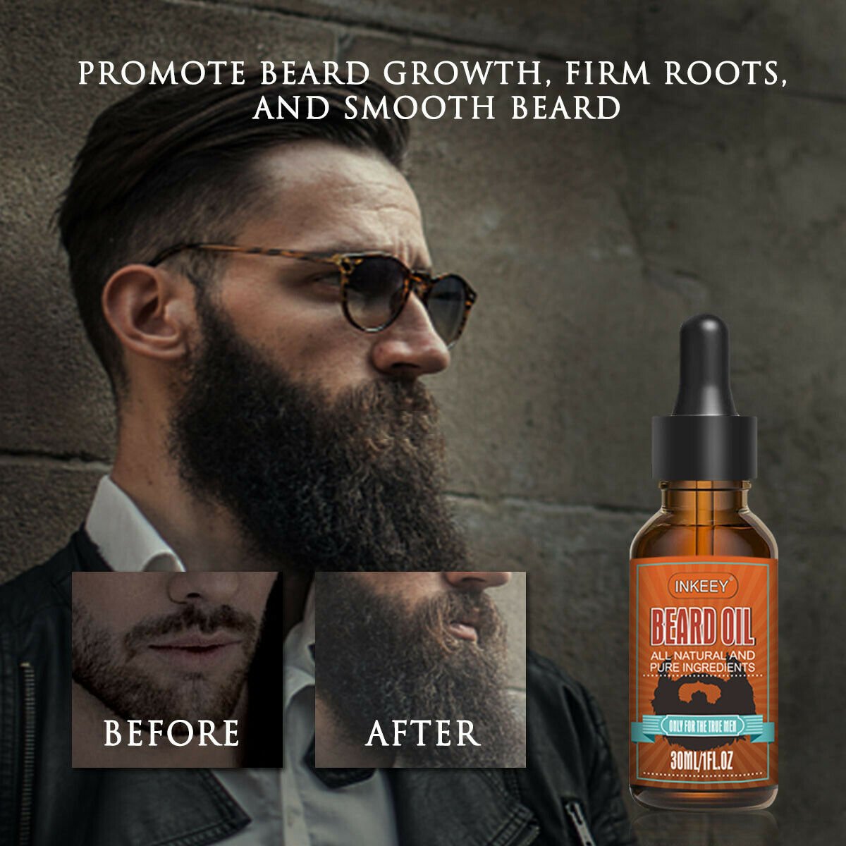 TrendyAffordables Men's Beard Growth Oil - Nourishing & Styling - TrendyAffordables - 5